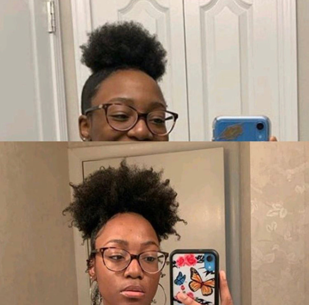 How to Grow Hair Faster: 5 Tips That Actually Work